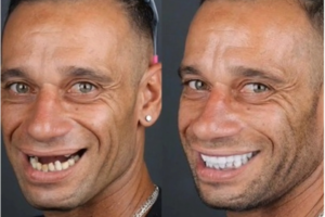 Douglas Martins - Casal Maloka